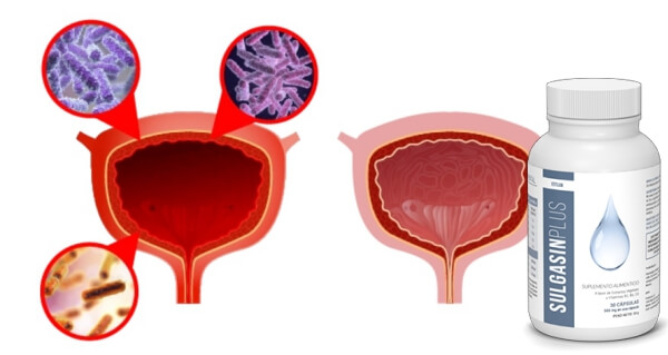 Cistitis , sulgasin plus capsulas