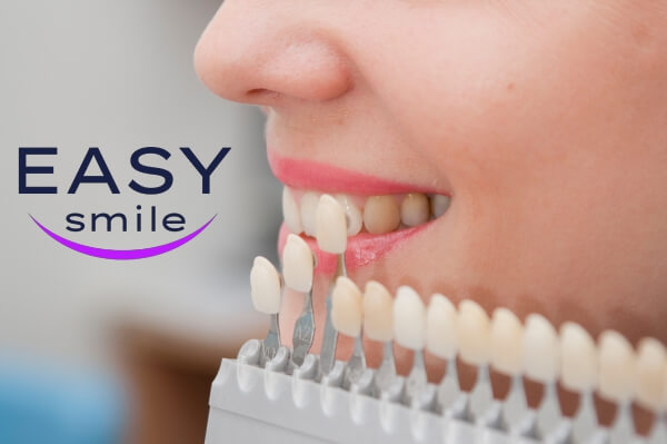 dientes blancos sonrisa carillas