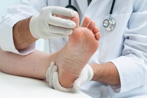 Infección fúngica en los pies - Síntomas y tratamiento