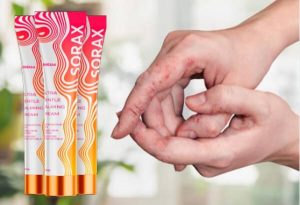 Sorax: crema totalmente natural y eficaz para calmar la piel psoriásica