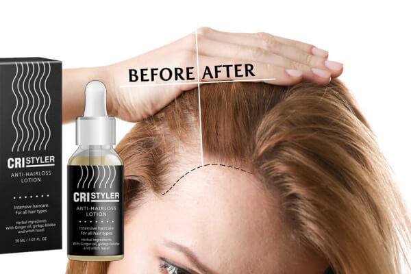 Cristyler serum para recrecimiento del cabello