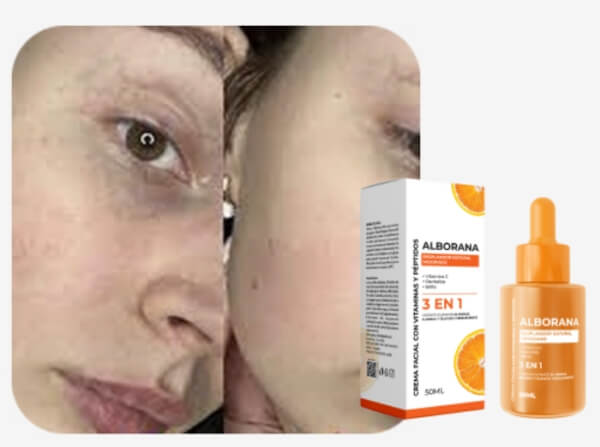 ¿Qué es Alborana y para qué sirve?